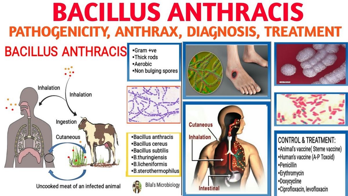 Anthrax Bacillus Anthracis Causes Symptoms Diagnosis Treatment