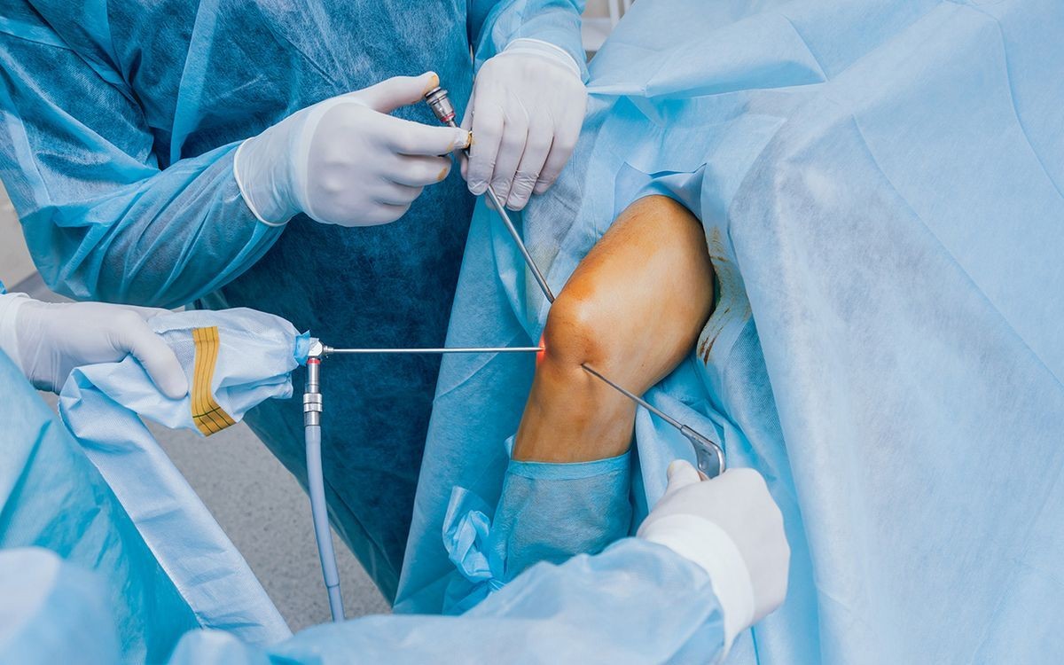 Arthroscopy Procedure Preparation Recovery Time