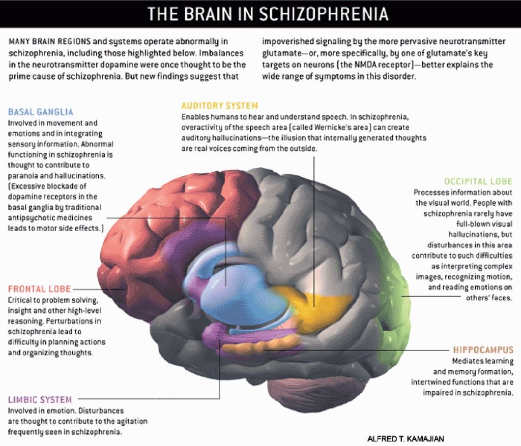 Can a Person Die from Schizophrenia