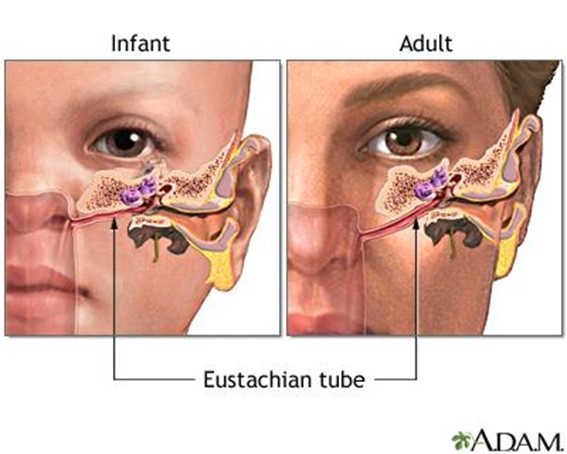 Eustachian Tube Dysfunction Causes Signs Treatment Surgery