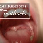 16 Home Remedies for Toothache