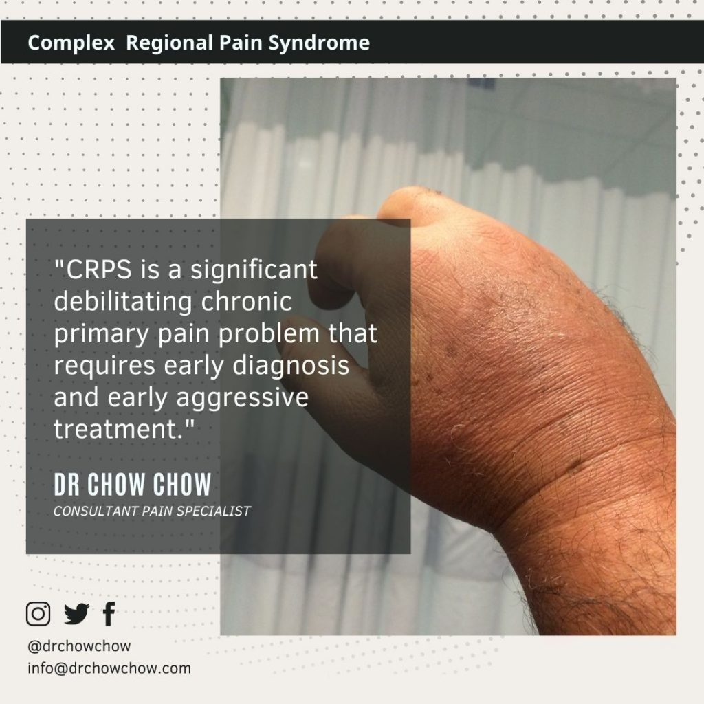 3 Stages of Complex Regional Pain Syndrome CRPS Treatment