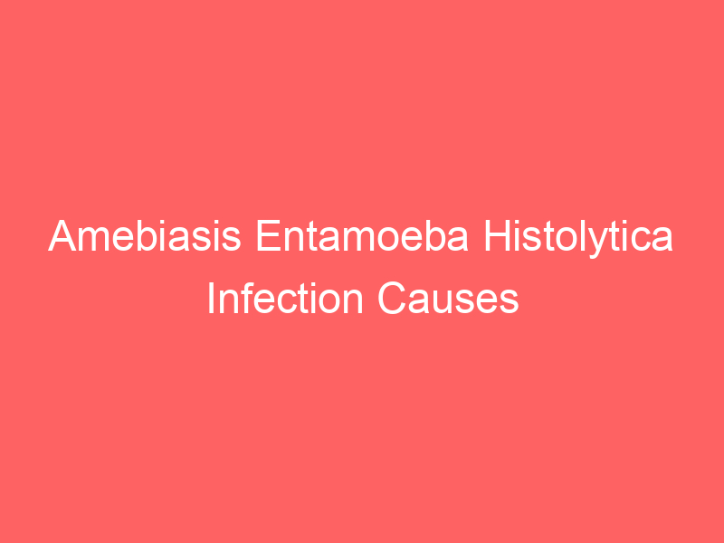 Amebiasis Entamoeba Histolytica Infection Causes Symptoms Diagnosis Treatment