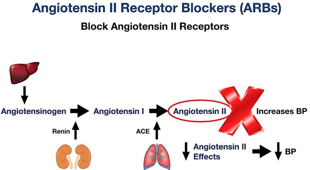 Angiotensin II Receptor Blockers ARBs vs Calcium Channel Blockers CCBs
