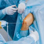 Arthroscopy Procedure Preparation Recovery Time