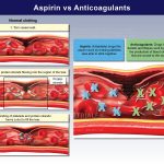 Aspirin vs Eliquis apixaban Bloodthinner Uses Side Effects