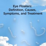 Black Eye Meaning Causes Symptoms Treatment Floaters