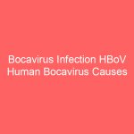 Bocavirus Infection HBoV Human Bocavirus Causes Symptoms Treatment Transmission