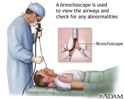 Bronchoscopy Indications Test Procedure Steps Side Effects