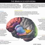 Can a Person Die from Schizophrenia