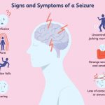 Can a Person With Epilepsy Live a Normal Life