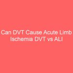 Can DVT Cause Acute Limb Ischemia DVT vs ALI