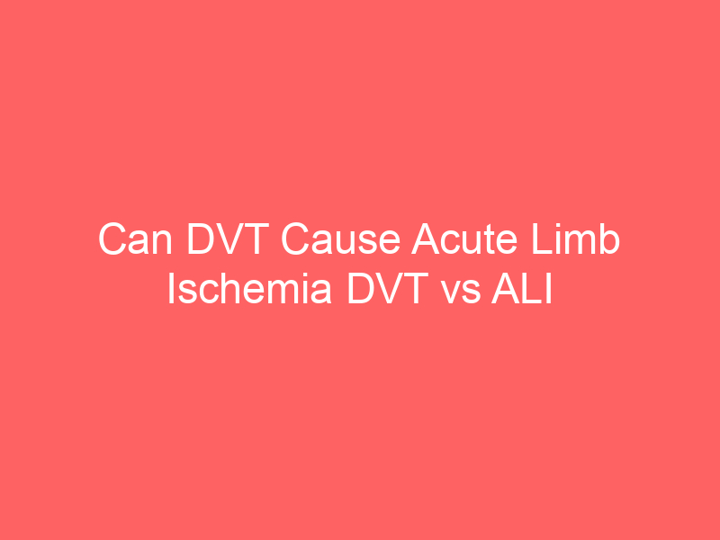 Can DVT Cause Acute Limb Ischemia DVT vs ALI