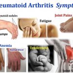Can Rheumatoid Arthritis Be Caused by Stress Anxiety IBD Symptoms