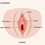 Can Vulvar Cancer Be Cured Treatment Risks 4 Stages