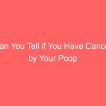 Can You Tell if You Have Cancer by Your Poop