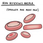 Carbonyl Iron Anemia Uses Warnings Side Effects Dosage
