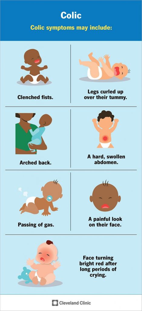 Colic in Babies Symptoms Treatment Causes Remedies