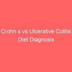 Crohn s vs Ulcerative Colitis Diet Diagnosis Treatment