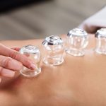 Cupping Therapy Types Benefits Side Effects