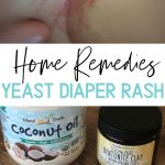 Diaper Rash Treatment Types Symptoms Causes Remedies