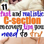 Does Walking Help C-Section Recovery 10 Tips Exercises