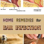 Ear Infection Home Treatment Pain Remedies How to Stop It
