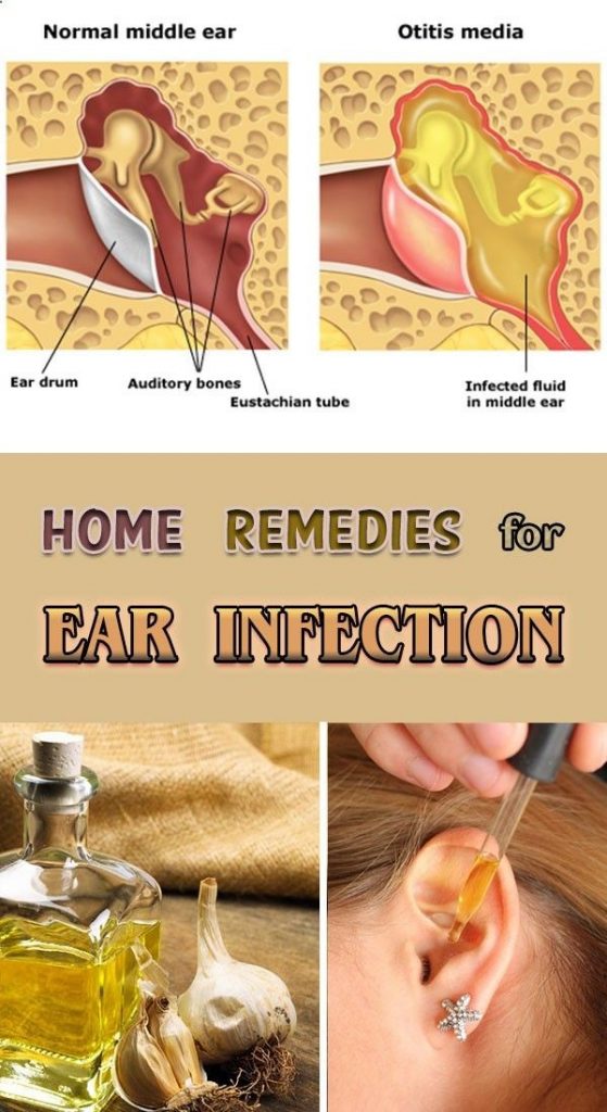 Ear Infection Home Treatment Pain Remedies How to Stop It