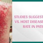 Graft Versus Host Disease GVHD Symptoms Treatment Prognosis