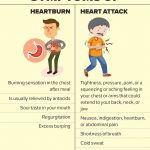Heartburn vs Heart Attack Similarities Differences