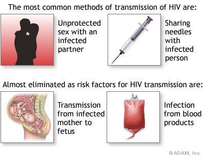 HIV Infection Facts History Causes and Risk Factors