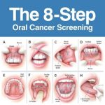 How Do You Detect Oral Cancer 6 Signs Symptoms Diagnosis