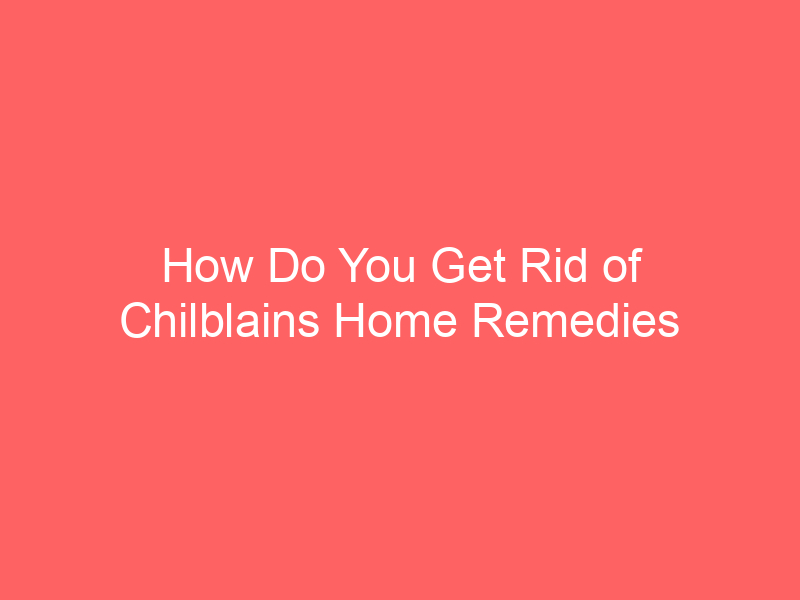 How Do You Get Rid of Chilblains Home Remedies Treatment