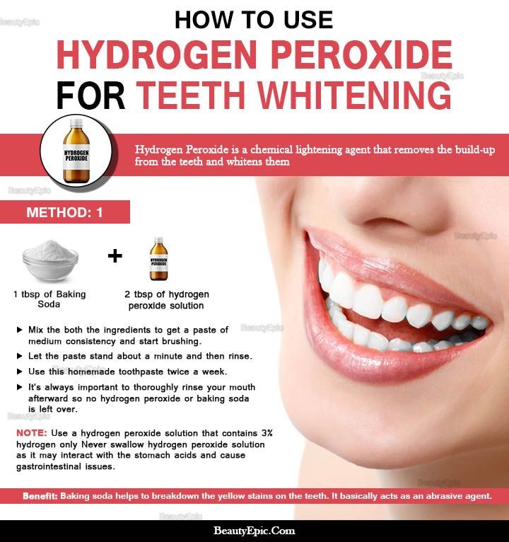 How Long Does It Take for Hydrogen Peroxide to Whiten Teeth