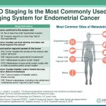How Serious Is Endometrial Cancer Survival Rate Stages