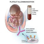 Human Platelet Antigen-1a Uses Side Effects Dosage