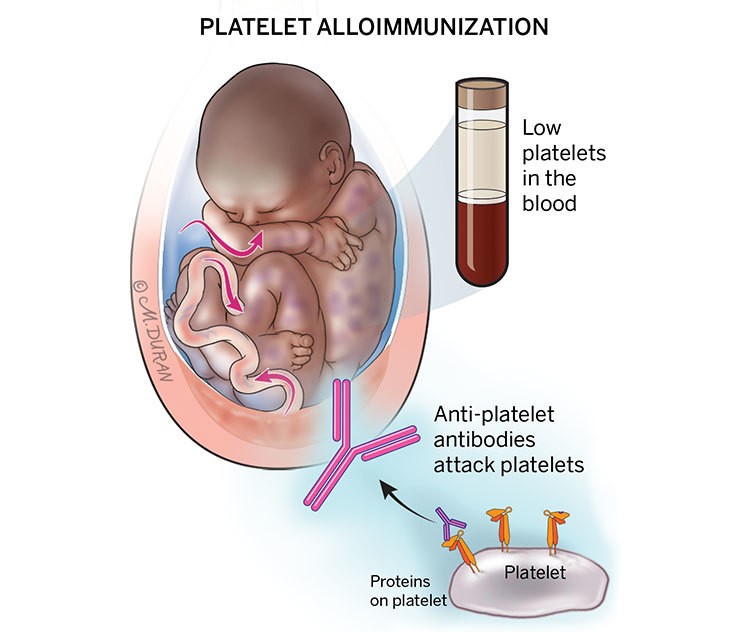 Human Platelet Antigen-1a Uses Side Effects Dosage
