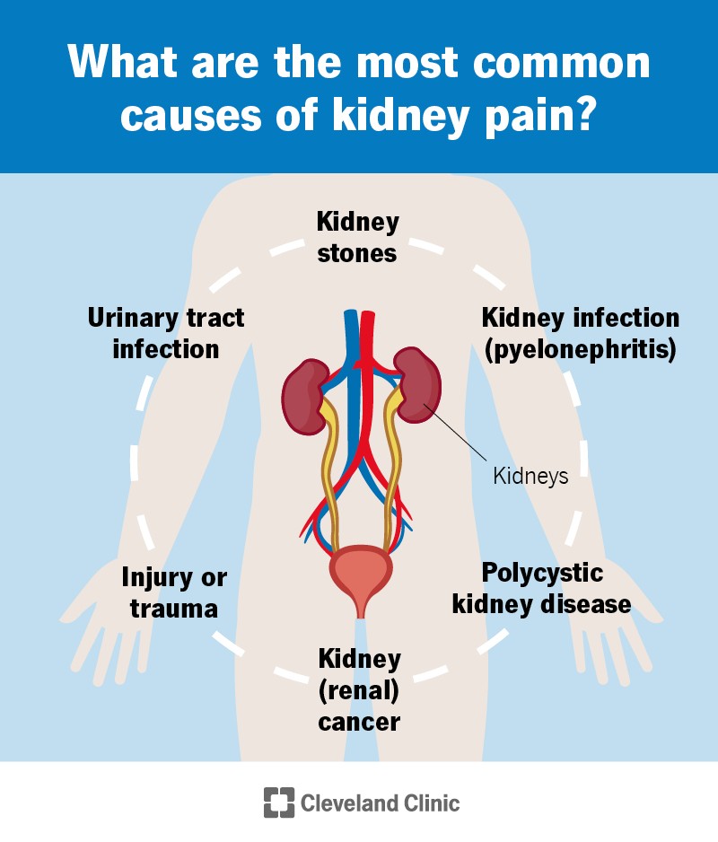 Kidney Pain Symptoms Location Causes Treatment Failure