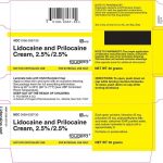 LIDOCAINE PRILOCAINE DISC – TOPICAL Emla side effects medical uses and drug interactions