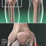 Medial Collateral Ligament MCL Symptoms Tests Treatment
