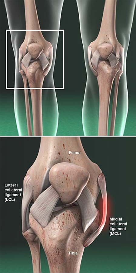 Medial Collateral Ligament MCL Symptoms Tests Treatment
