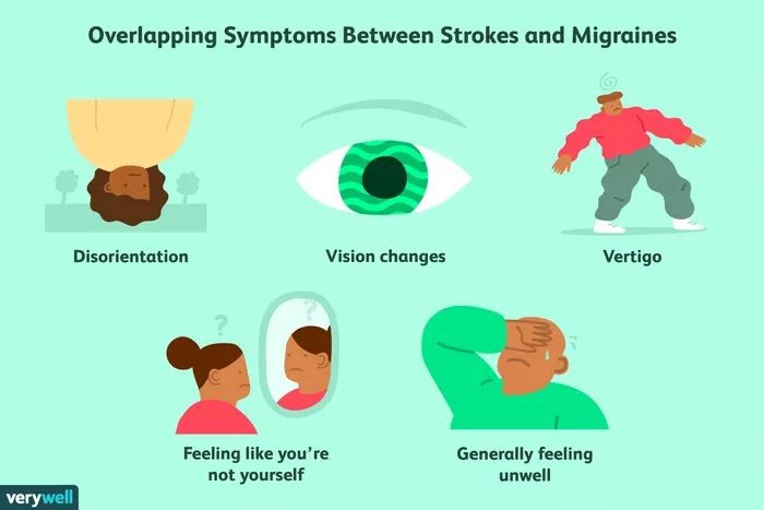 Migraine and Stroke Symptoms Differences and Similarities