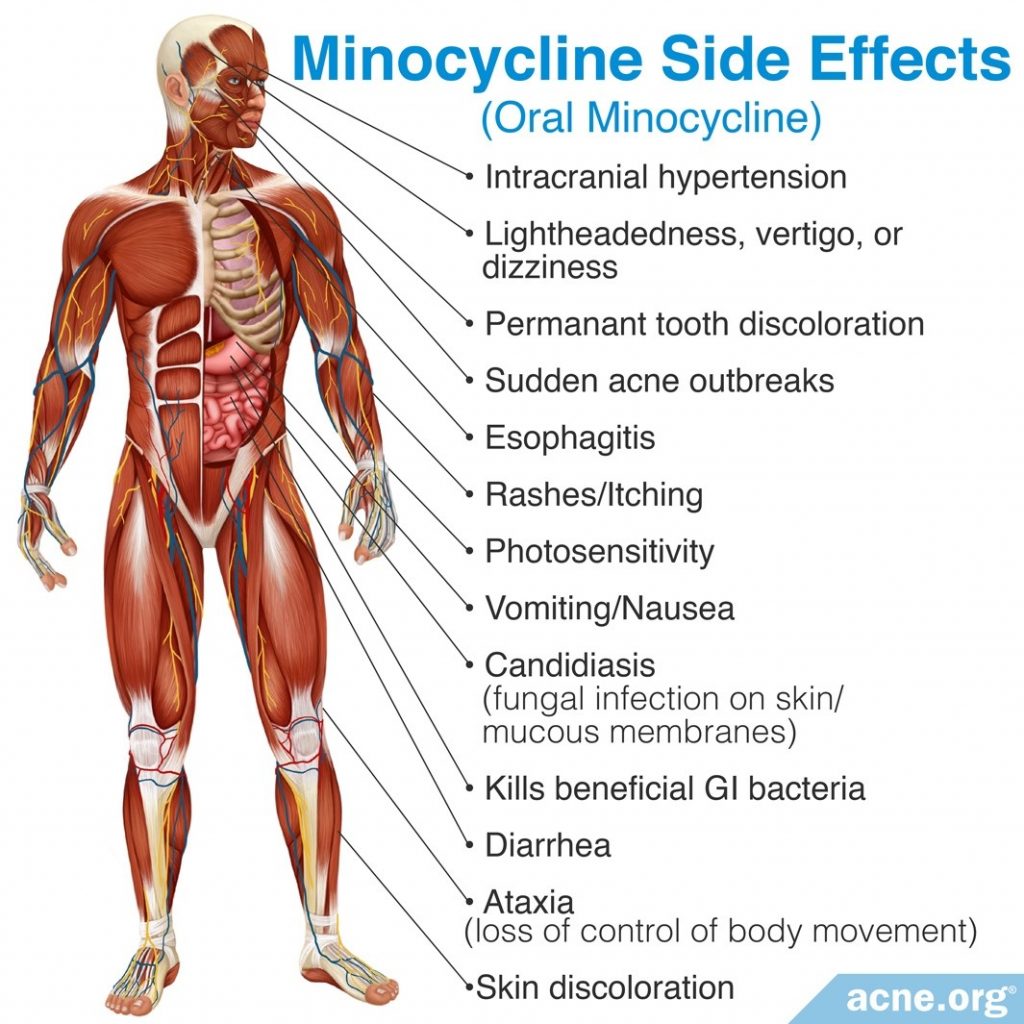 MINOCYCLINE – INJECTION Minocin side effects medical uses and drug interactions