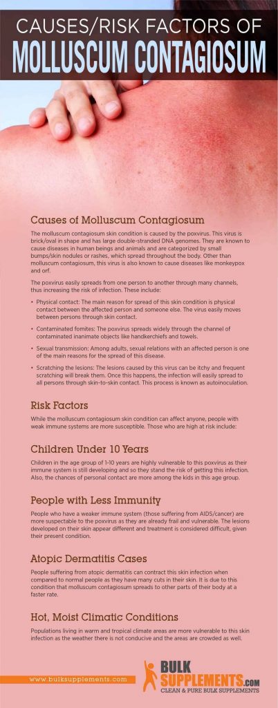 Molluscum Contagiosum Pictures Stages Symptoms Treatment