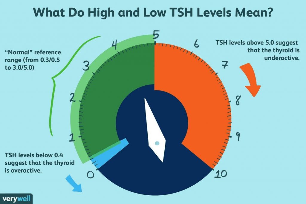 Normal High Low TSH Levels in a Woman Chart Abnormal Levels