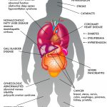 Obesity and Fatty Liver disease on