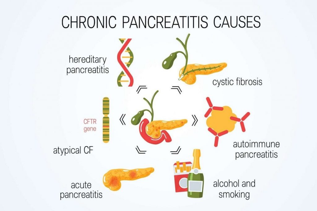 Pancreatitis Acute Chronic Symptoms Treatment Causes