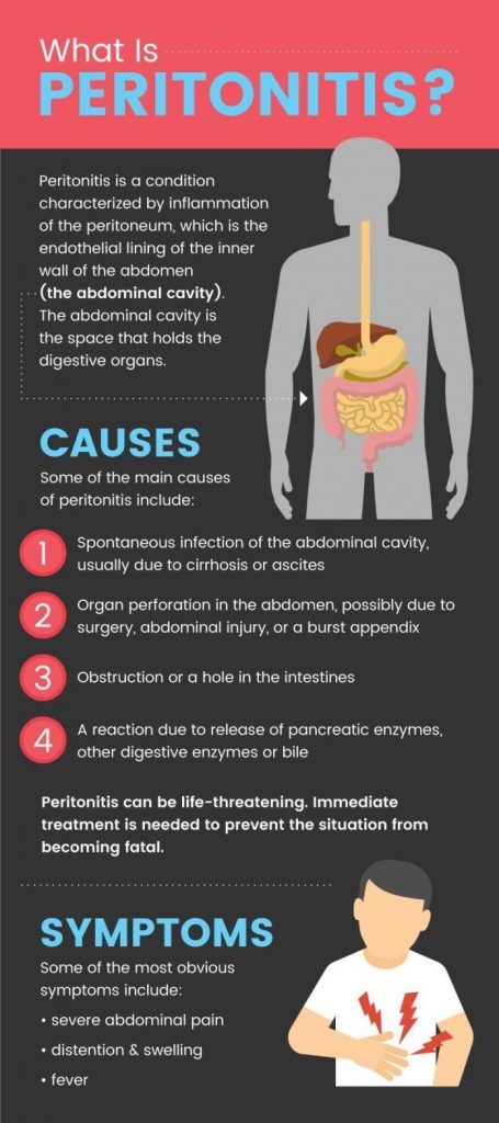 Peritonitis Causes Stages Symptoms Diagnosis Treatment