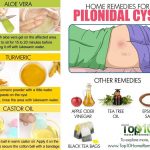 Pilonidal Cyst Pain Treatment Surgery Causes Symptoms