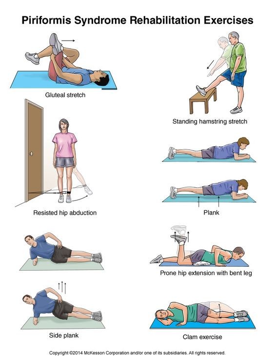 Piriformis Syndrome Causes Symptoms Exercises Treatment